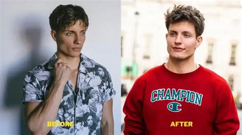 matt rife skinny|Matt Rife Explains Changing Appearance Amid Plastic Surgery。